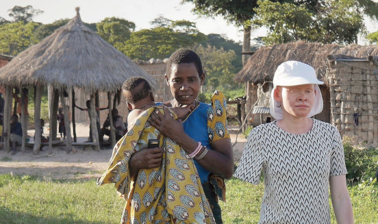 Wyposażenie domu dla albinosów w Mwanza (Tanzania)